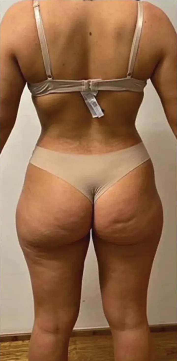 Percorso di trasformazione numero 1, prima del percorso